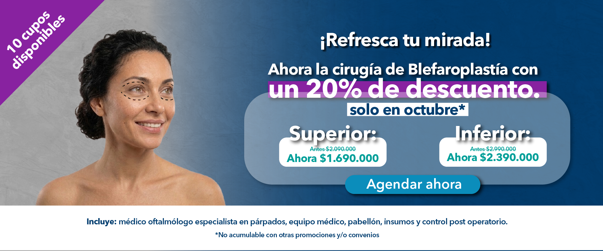 B_29sep26_Octubre blefaroplastia_IOES_Mesa de trabajo 1 copia 16